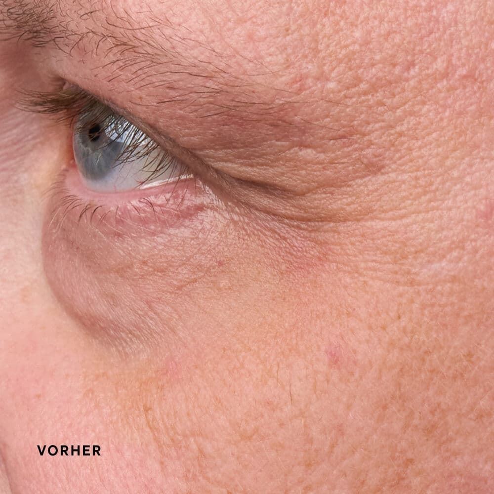LONGEVITY EYE CREAM - Imagen 4